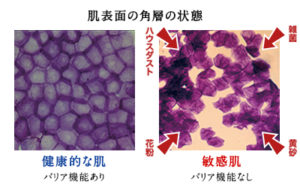 敏感肌のバリア機能について